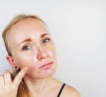 Home Remedies For Oily Skin That Work Well