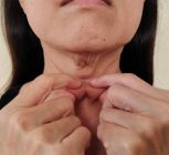 How To Treat Neck Wrinkles? 6 Effective Ways to Treat Them